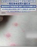 客反映入住后被臭虫、螨虫叮咬